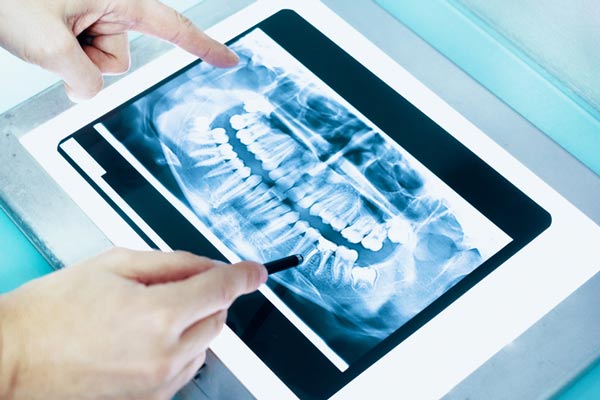 Dental x-ray of a full mouth